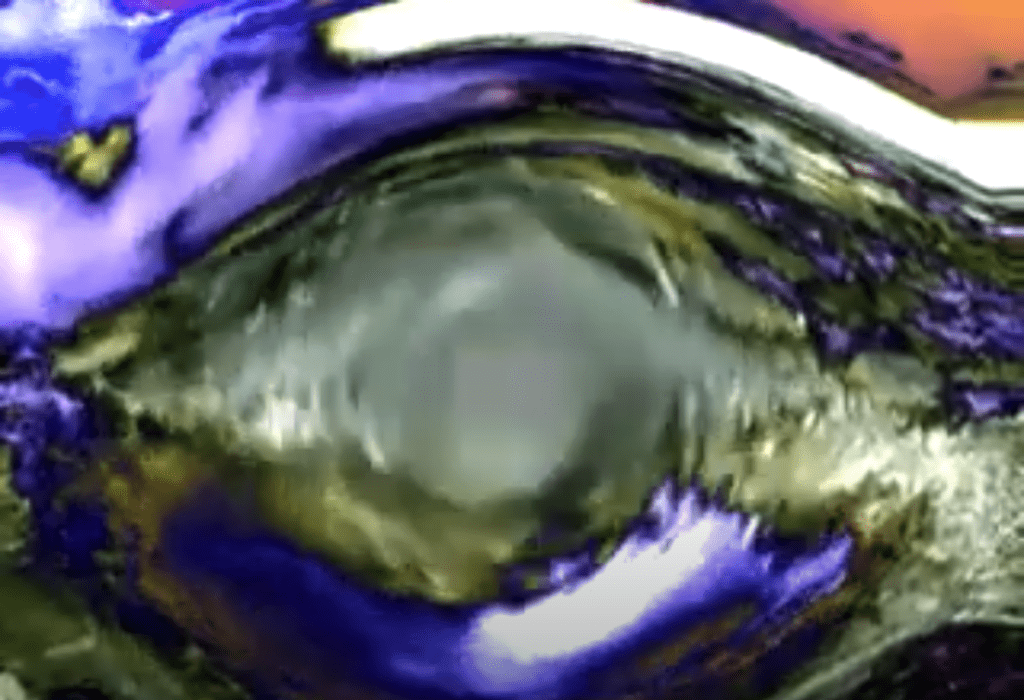 eye